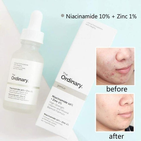 Ordinary Serum Niacinamide 10% zinc 1% 30 ml